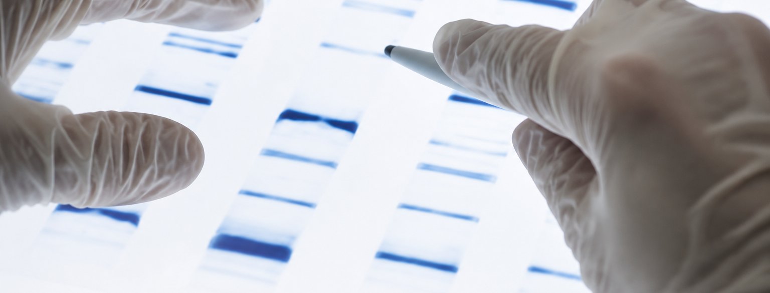 AP-4® scientists analysing DNA gel results in the lab