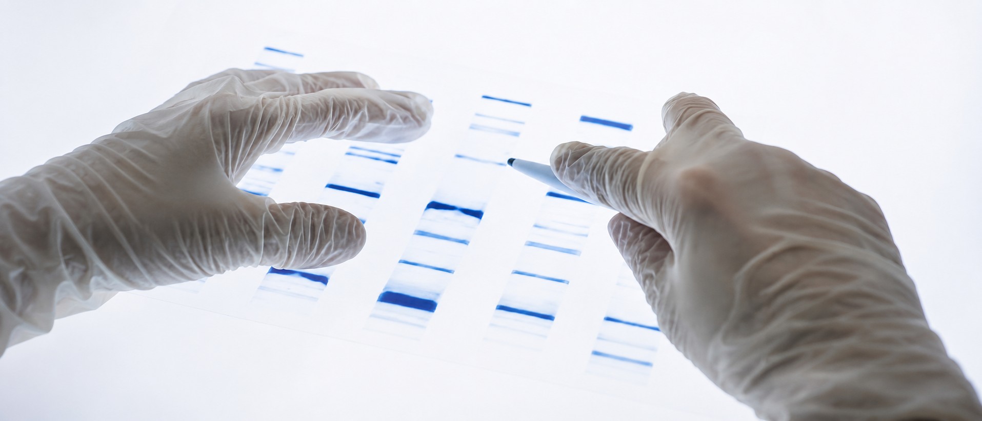 Two gloved hands examining a DNA gel electrophoresis result used to verify the AP-4® rosehip variety